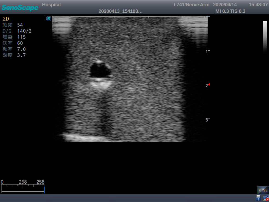 PICC Ultrasound Training Model 