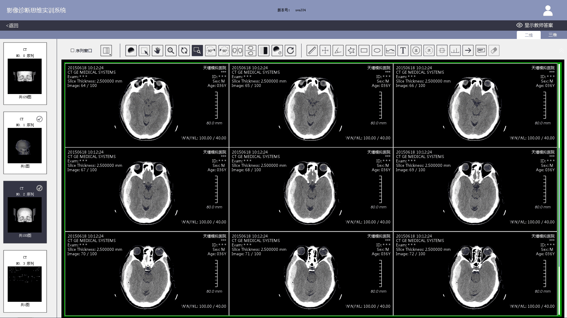 Image Diagnostic Thinking Training System